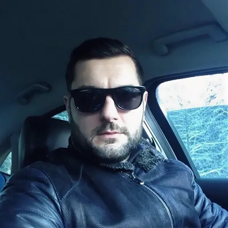 Синдром Дауна у плода