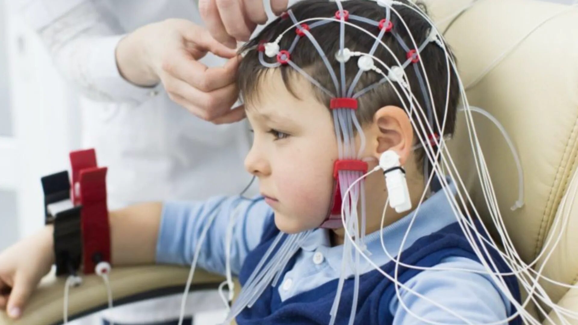 Электроэнцефалография (ЭЭГ). РЭГ И ЭЭГ. Электроэнцефалография у детей. Энцефалограмма головы.