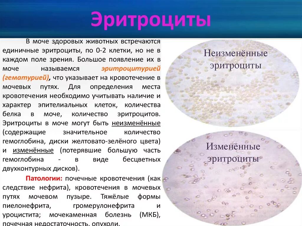 Почему повышенный эритроциты в моче. Измененные эритроциты в моче 1-3. Измененные и неизмененные эритроциты в микроскопии мочи. Неизмененные эритроциты в моче. Выщелоченные эритроциты в моче.