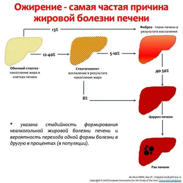 Причины жирового гепатоза печени лечение. Жировой гепатоз печени симптомы. Причины жирового перерождения печени. Жировое Перерождение печени схема. Гепатоз ожирение печени.