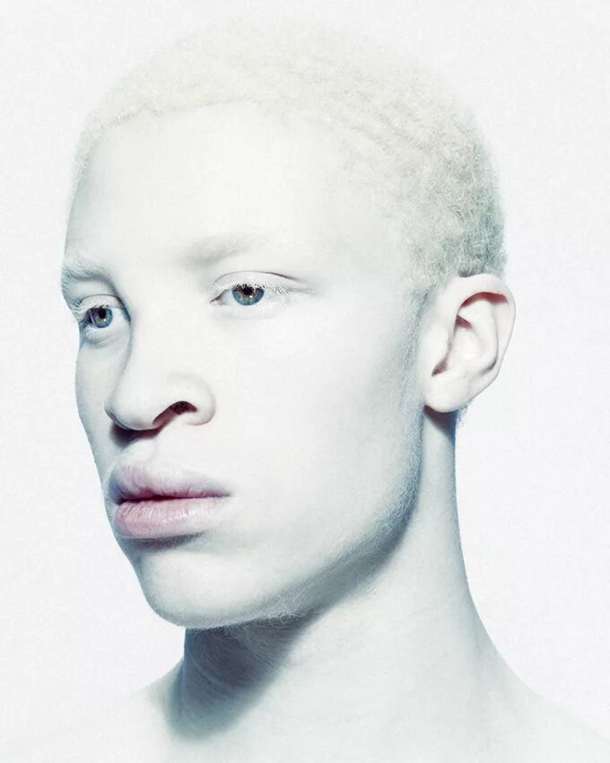Белый негр. Негр альбинос Шон Росс. Шон Росс в аиу. Модель альбинос Шон Росс. Джуэл Джеффри фотомодель альбинос.