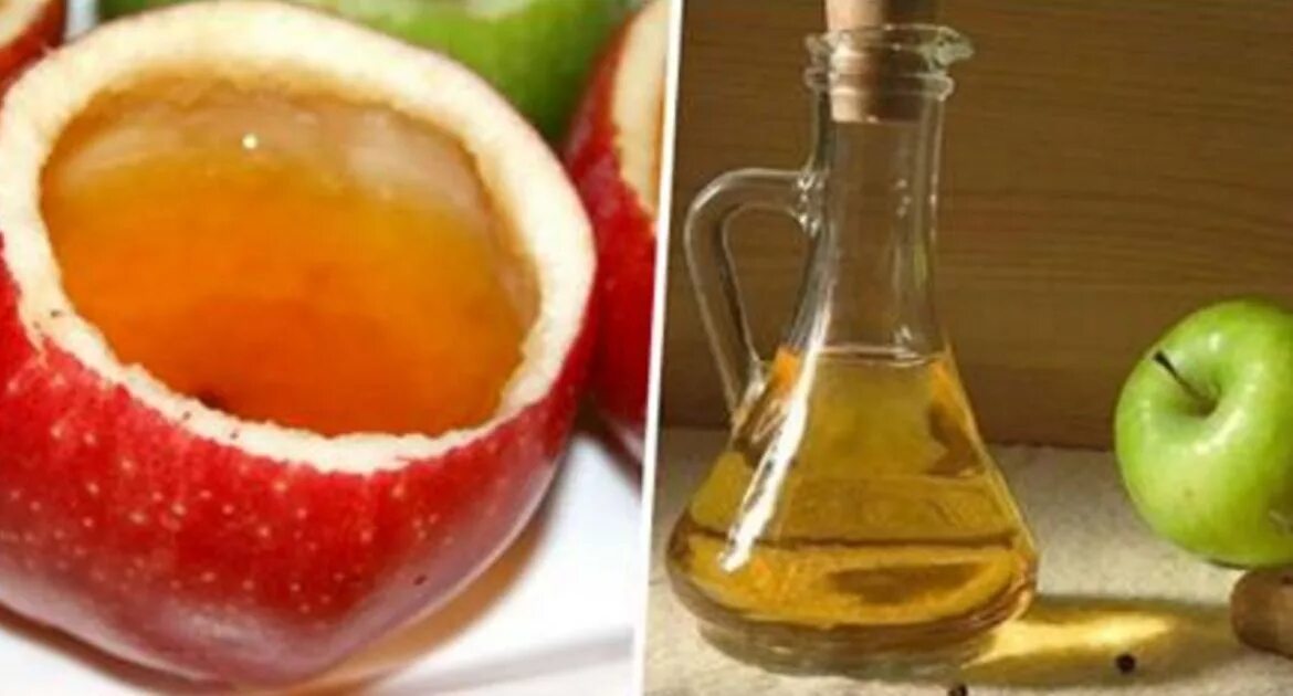 Можно ли яблочный уксус при гастрите. Apple cider vinegar. Уксус apple vinegar. Рецепт яблочного уксуса в домашних. Уксус apple vinegar.