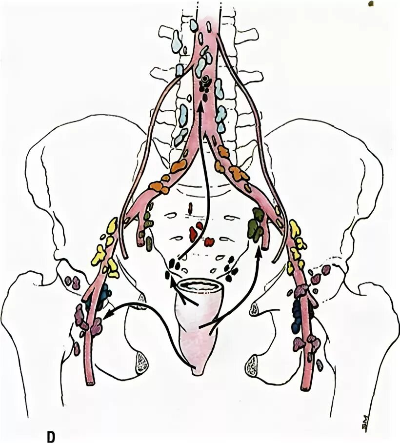 Лимфоузлы слева в паху. Лимфатическая система таза. Парааортальные лимфоузлы. Лимфатическая система малого таза. Подвздошные лимфоузлы анатомия.