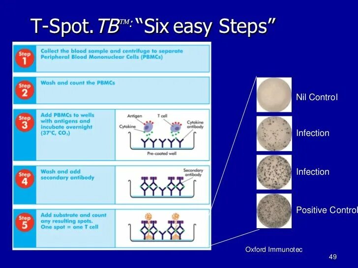 Easy steps 2. Т спот ТБ. Т-спот тест. T spot тест на туберкулез. Т-спот антиген a (Esat-6).