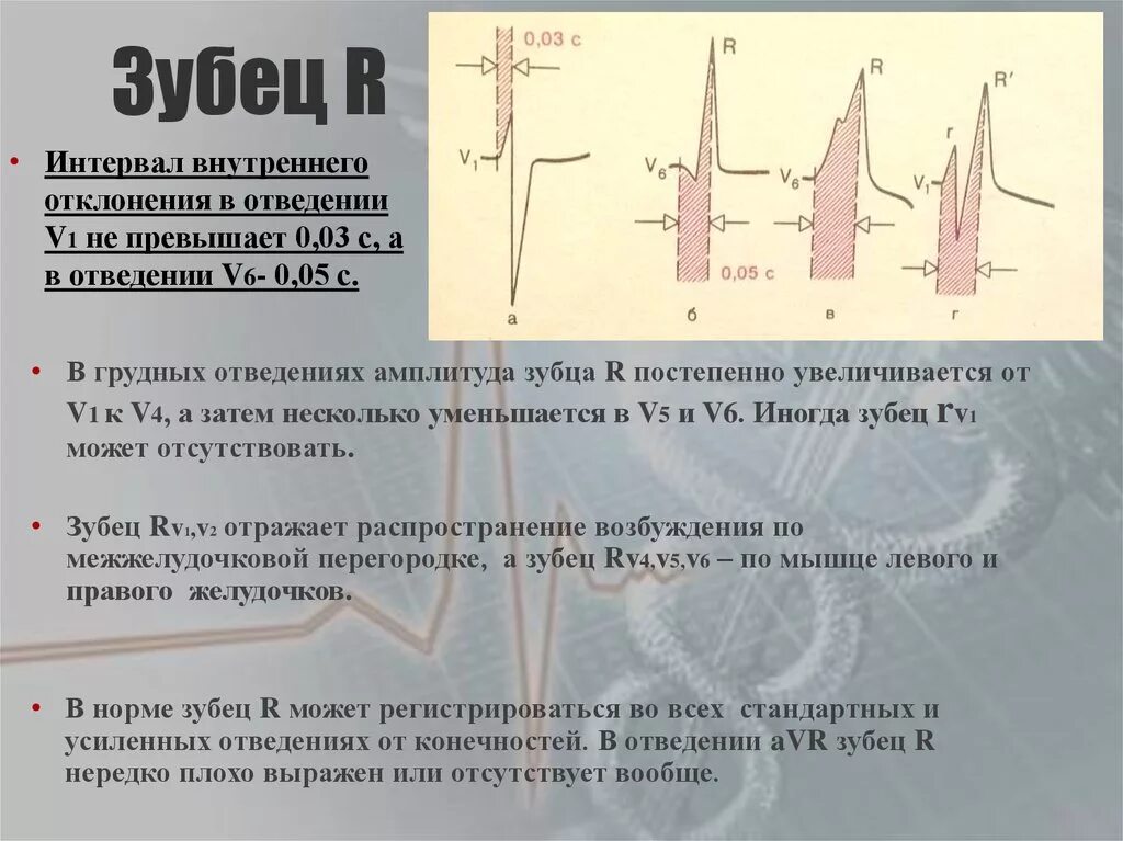 Нарастание зубца. Расщепление зубца r в v3. Зубец r1 и r на ЭКГ. Расщепление зубца р в 3 отведении. Зубцы ЭКГ R зубец.