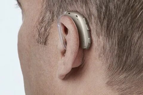 Oticon xceed слуховой