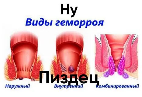 Пизда порно фото ішіндегі микро камера