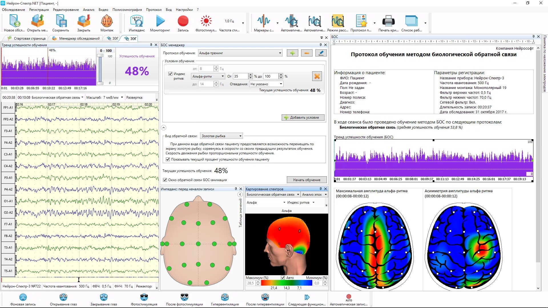 ЭЭГ аппарат Нейрон спектр 3. Аппарат ЭЭГ Нейрософт. Прибор Нейрон спектр 2 энцефалограммы. Протокол обследования электроэнцефалограммы Нейрон спектр 1. Ээг в новосибирске
