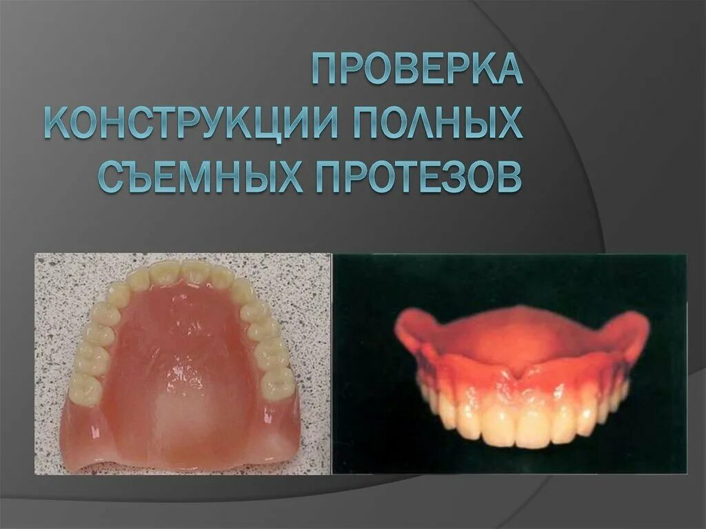 Ошибка протезирование