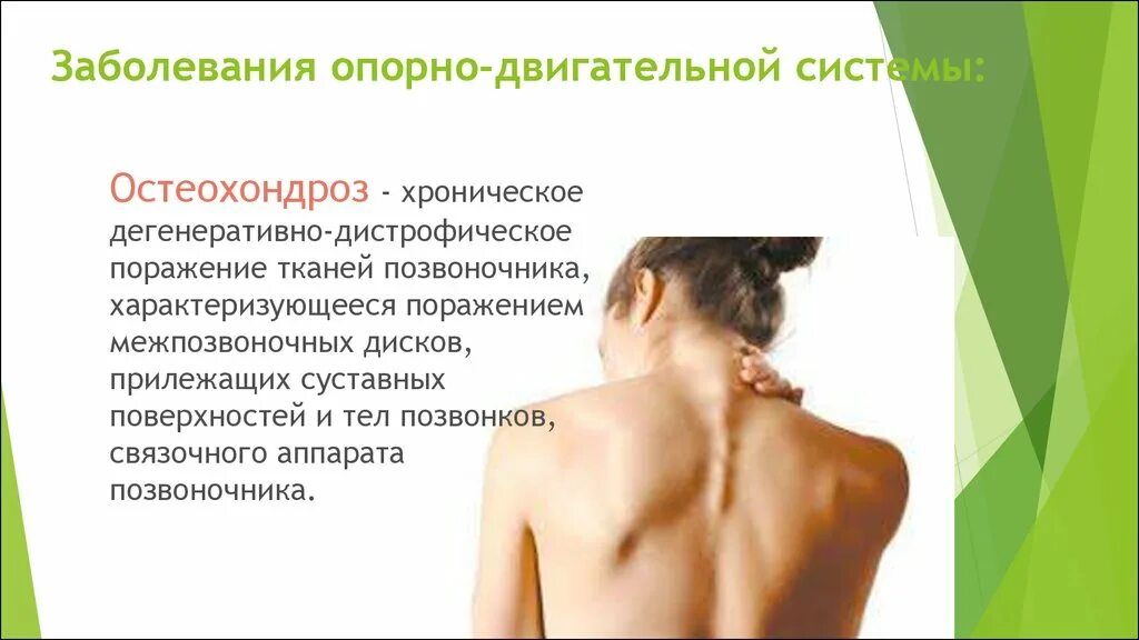 Нарушение двигательной системы. Заболевания опорно-двигательной системы. нарушение опорно двигательной системы. заболевание опорнодвирюгатеььной системы. заболевание опорно двигательной системы человека.