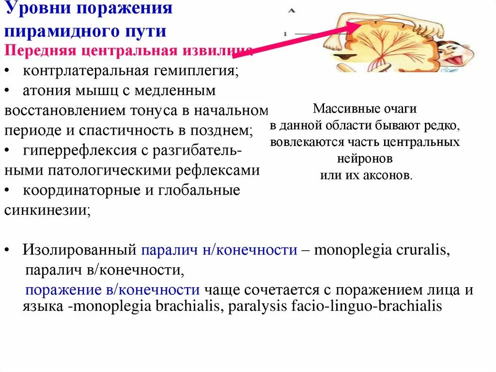 Двигательные симптомы поражения. Нарушение пирамидных путей симптомы. Симптомы поражения пирамидного тракта. Симптомы поражения пирамидного пути на различных уровнях. Двигательный анализатор пирамидный путь.