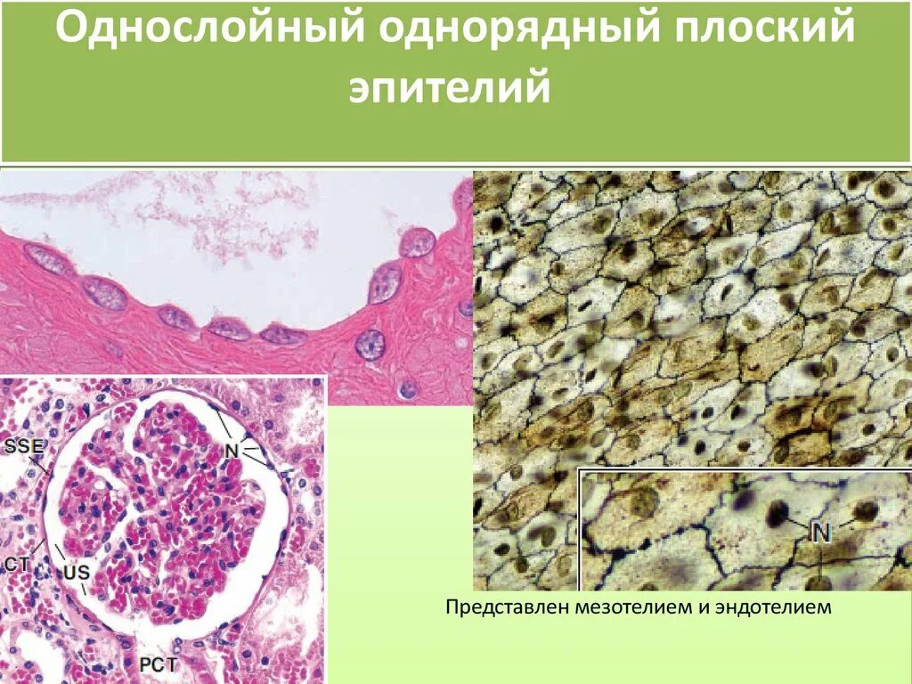 Однослойный плоский мезотелий. Эпителий эндотелий мезотелий. Мезотелий брюшины гистология. Однослойный кубический эпителий кролика. Однослойный плоский эпителий мезотелий импрегнация серебром.