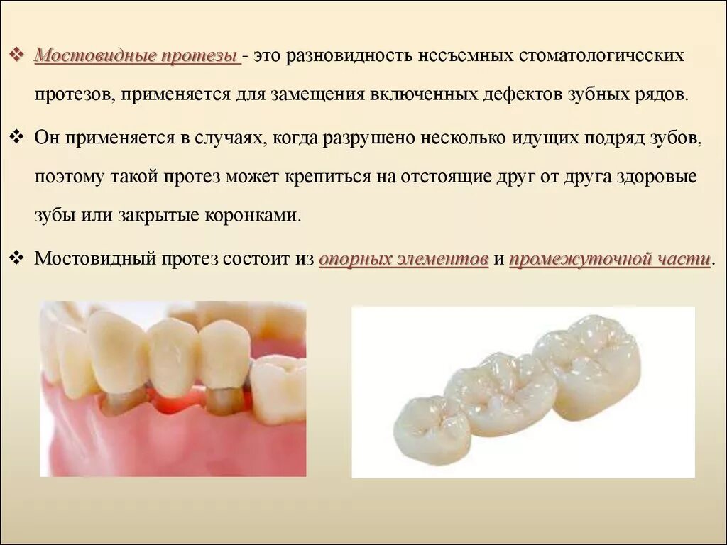 Противопоказания к изготовлению коронки. Характеристика съемных мостовидных протезов.. Зубной мост мостовидный протез несъемный. Мостовидный протез опорные зубы. Протезы мостовидные. Конструкционные элементы мостовидных протезов..