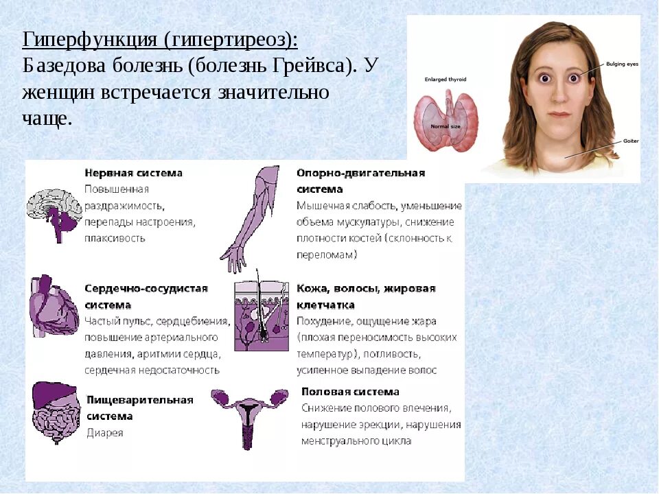 Клинические симптомы гипертиреоза. Гипертиреоз щитовидной железы. Базедова болезнь это заболевание эндокринной системы. Эндокринная система гипертиреоз.
