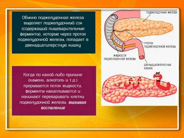 Вздутие поджелудочной железы. От чего воспаляется поджелудочная железа. От вздутия поджелудочной железы. Приступы болезни поджелудочной железы.