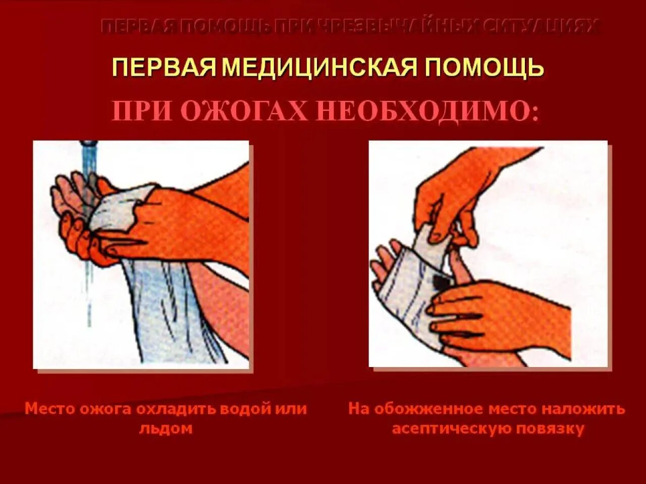 Как оказать помощь пострадавшему при ожоге. Оказание первой медицинской помощи при ожогах. 1 помощь при ожогах. оказание первой мед помощи при ожогах.