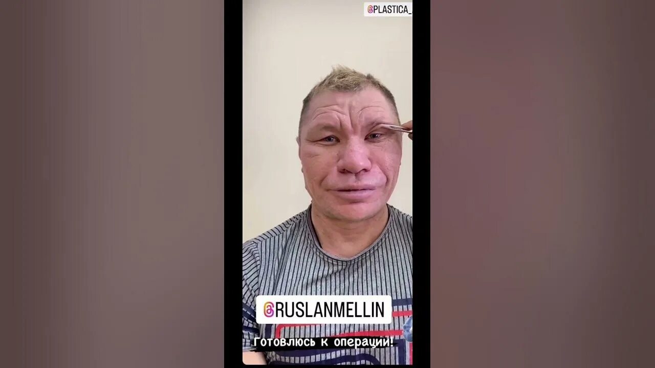 Монгол после операции. Монгол после операции