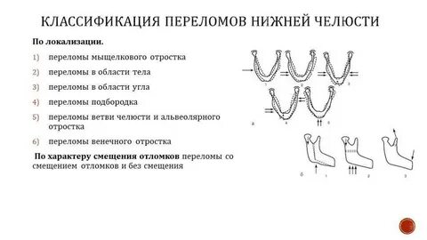 Переломы челюсти клинические рекомендации