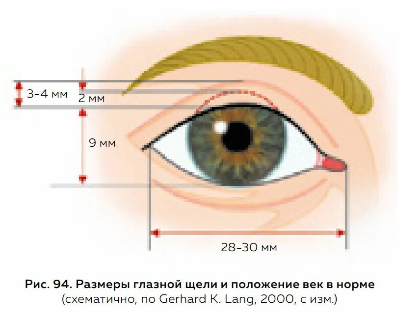 Веки 1 2. Форма глазной щели в норме. Нормальная ширина глазной щели. Ширина глазных щелей в норме у детей.