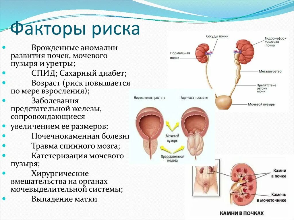 Пиелонефрит причины меры профилактики. Факторы риска хронического пиелонефрита. Факторы риска мочекаменной болезни. Мочекаменная болезнь факторыоичка риска. Факторы риска хронического гломерулонефрита.