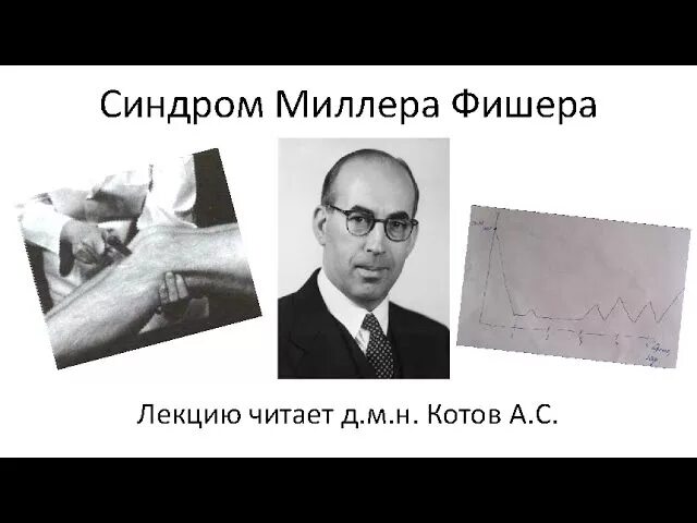 Синдром фишера. Синдром миллера фишера. Синдром фишера. Синдром миллера фишера. Синдром миллера-фишера и синдром гийена-барре.