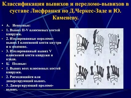 Классификация вывихов