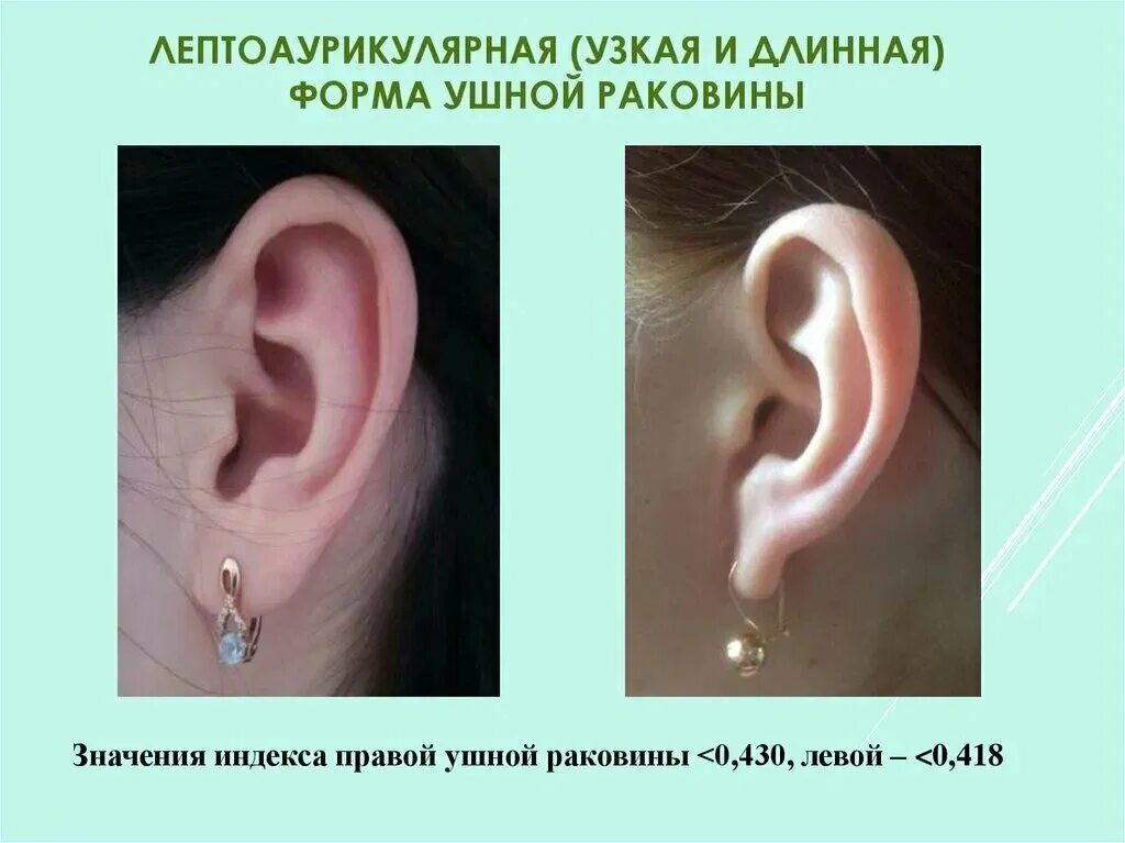Мочки ушей значение. Форма мочки ушной раковины. идеальная форма ушной раковины.