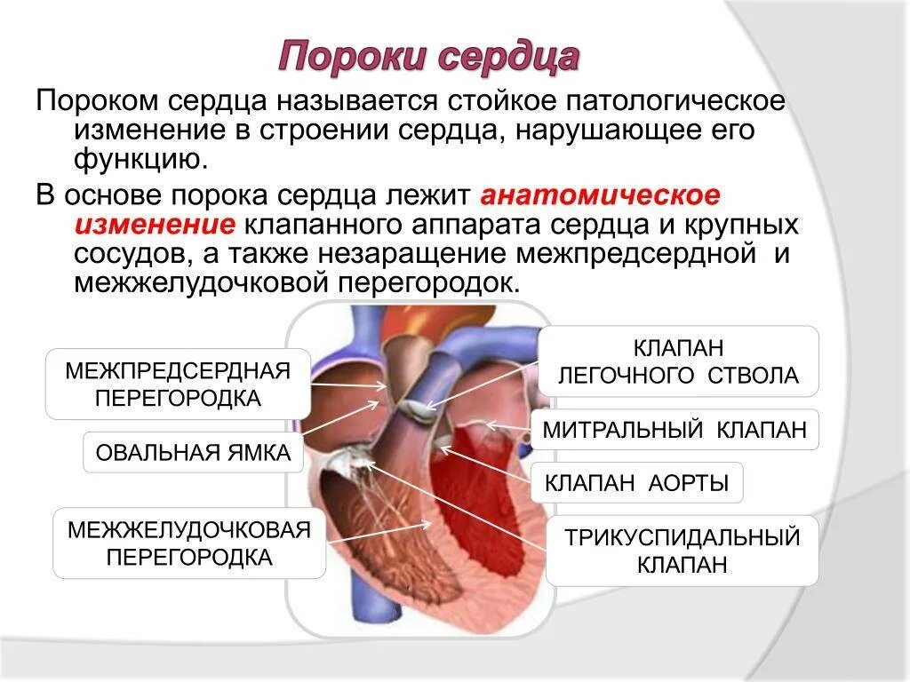 Заболевания сердца приобретенный порок. Врожденные и приобретенные пороки сердца. Наиболее распространенные пороки сердца. Патологии сердца врожденные и приобретенные пороки.