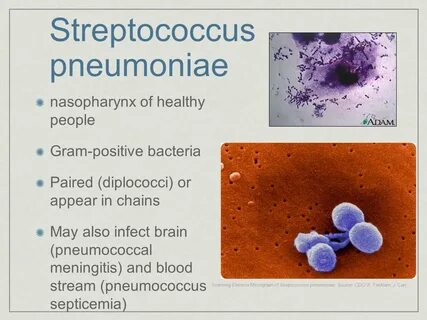 Streptococcus pneumoniae