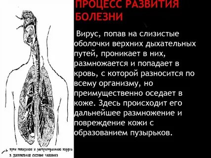 Оказалась болезнь