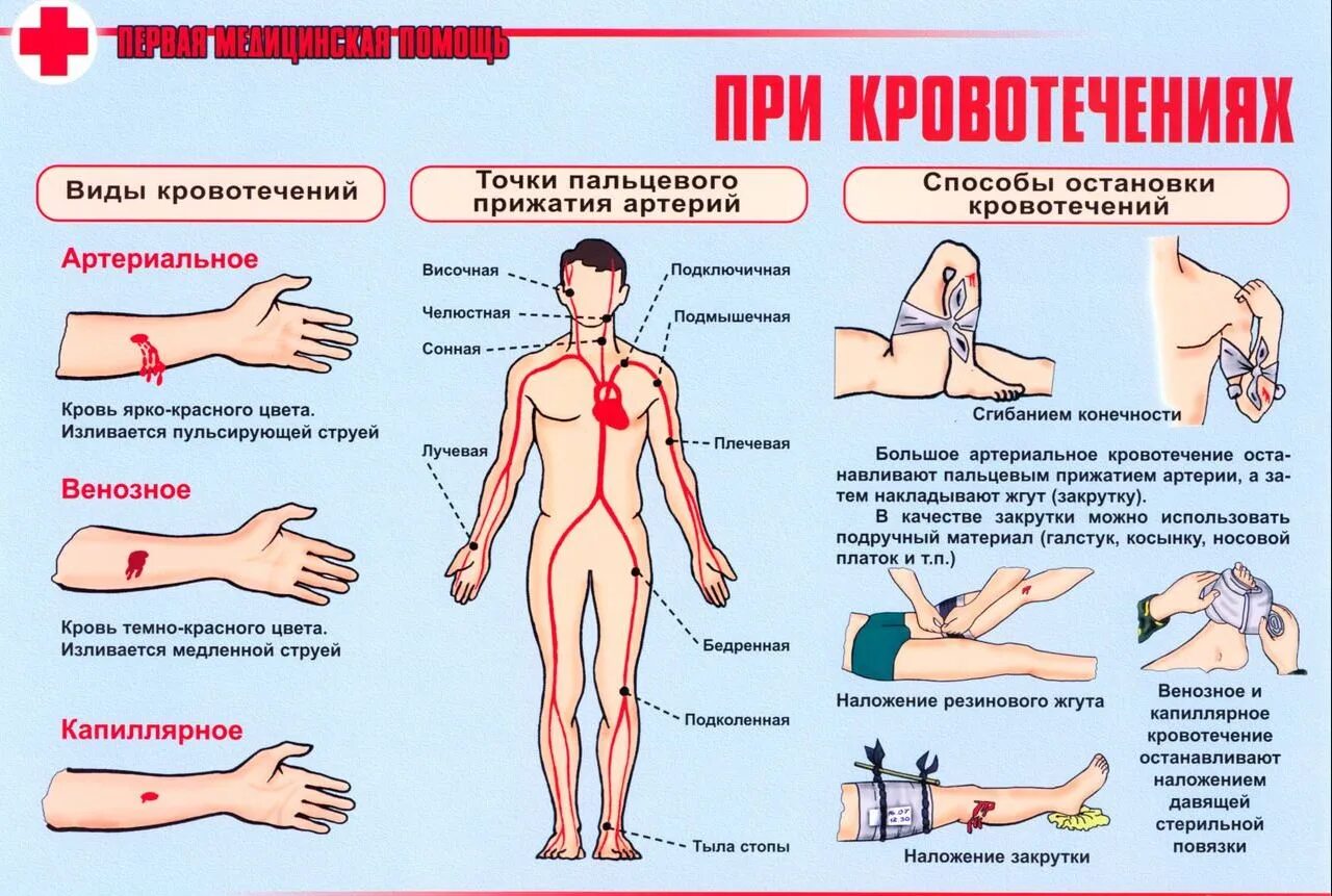 Оказание помощи при кровотечениях из раны. Порядок оказания первой помощи при кровотечениях. Оказание первой медицинской при кровотечении. Памятка 1 помощь при кровотечении. ПМП при артериальном кровотечении.