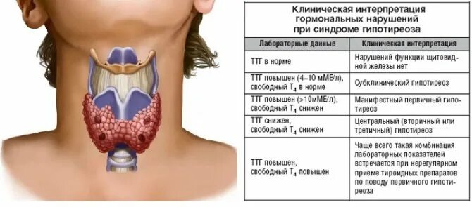 Щитовидная железа т3 т4. Щитовидной железа ТТГ И т4. 3 Основных гормона щитовидной железы у женщин. Анализы на щитовидную железу.