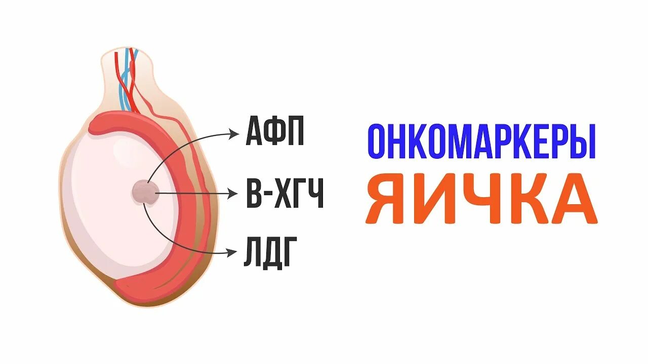 Онкомаркеры яичка. Онкомаркеры опухоли яичка.