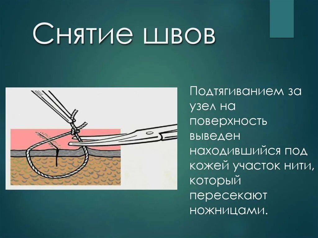 Где снять швы в москве Telegraph