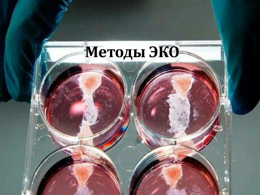 Что такое эмбрионы при эко. Этапы экстракорпоральное оплодотворение. культивирование эмбрионов. эко это искусственное оплодотворение. методика экстракорпорального оплодотворения (эко).