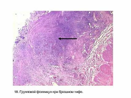 Групповые фолликулы