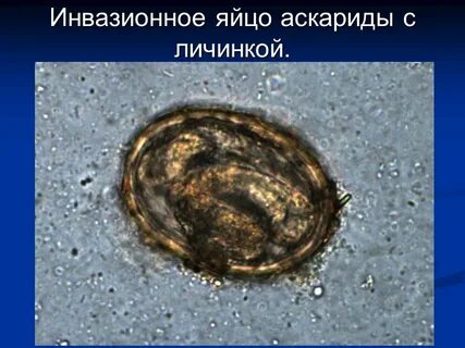 Инвазионная личинка