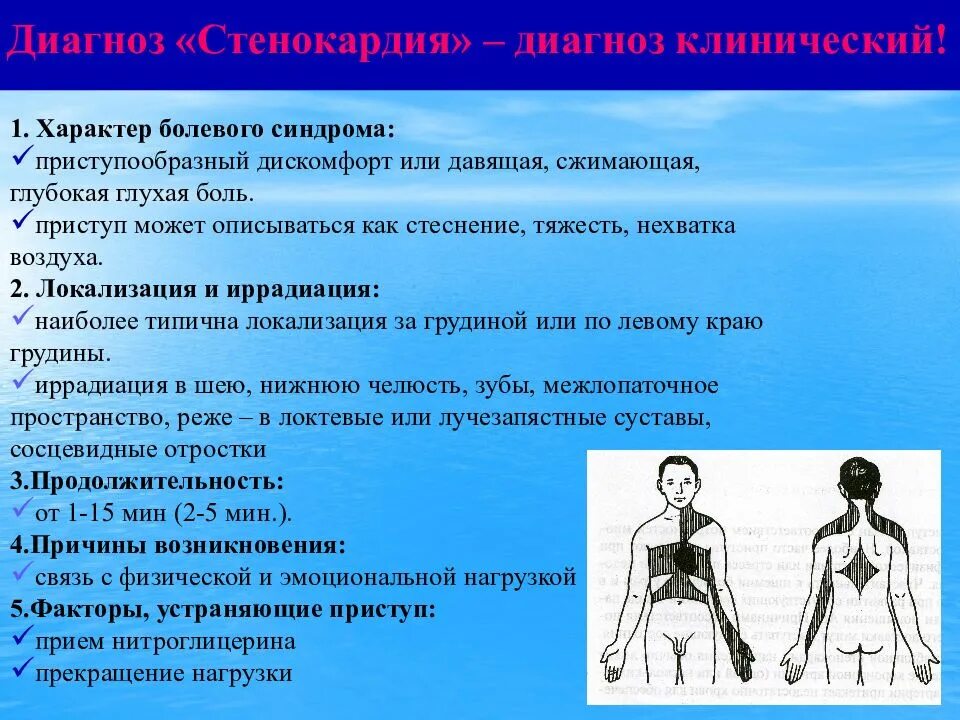 Иррадиация стенокардии. Стенокардия иррадиация. Сестринский диагноз при стенокардии. Проблемы пациента при ИБС стенокардии. План сестринской помощи при стенокардии.