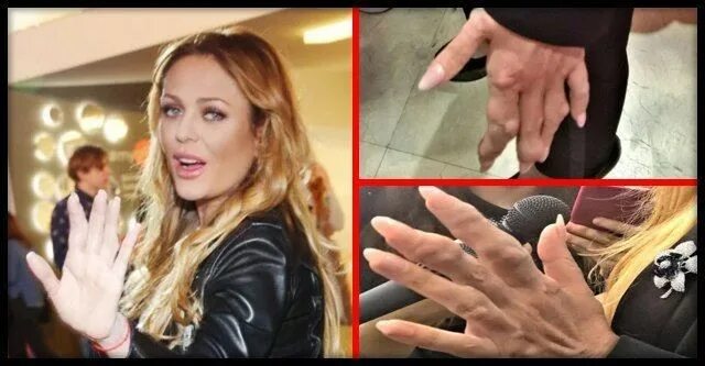 Болезнь певицы. Болезнь певицы. Билли айлиш и аврил лавин. Началова 2007. Болезнь певицы.