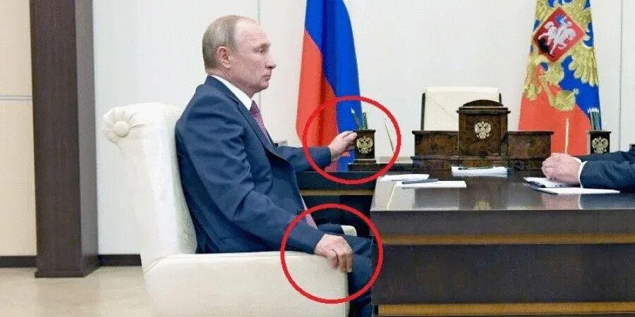 Болезнь Путина.