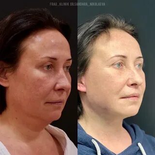 Сандара афанасьевна пластический хирург