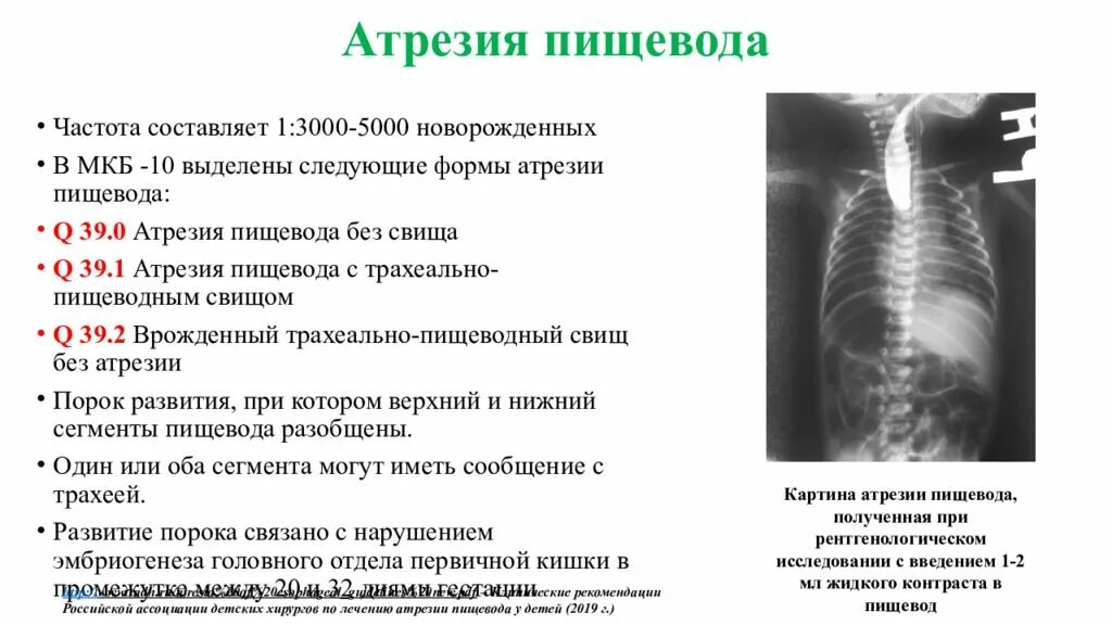 Атрезия пищевода классификация. Атрезия пищевода у новорожденных. Атрезия пищевода без свища. Поврежденный пищевод