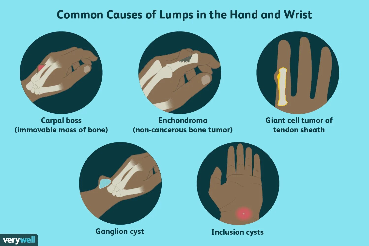 Hands как пользоваться