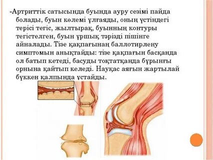 Керемет емізік