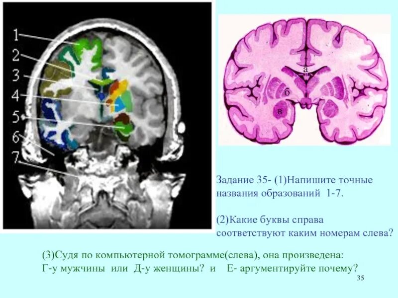 Задания на кт. Сегменты зма на кт. Межскуловая линия на кт. Гипдопс Лабиринта кт. Н 3 кт