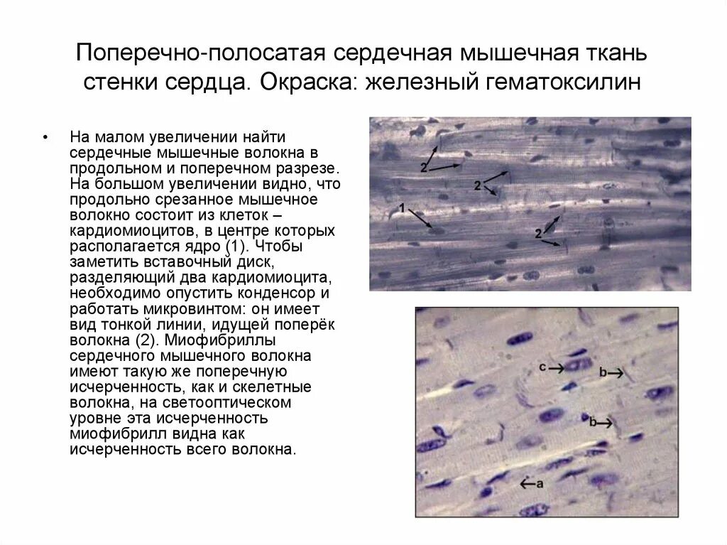 Состоит из клеток имеющих поперечную исчерченность. Сердечная мышечная ткань окраска Железный гематоксилин. Препарат сердечная мышечная ткань Железный гематоксилин. Поперечно полосатая сердечная мышечная ткань Железный гематоксилин. Поперечнополосатая мышечная ткань Железный гематоксилин.