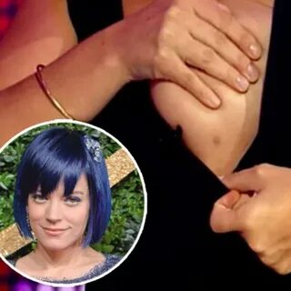 Lilly allen third nipple