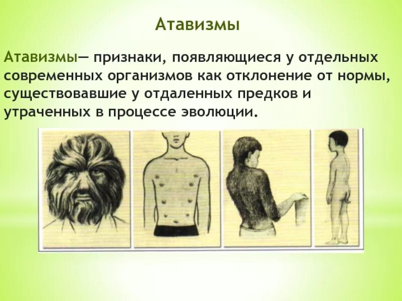 Атавизмы китообразных. Атавизмы доказательства эволюции. атавизм доказательство.