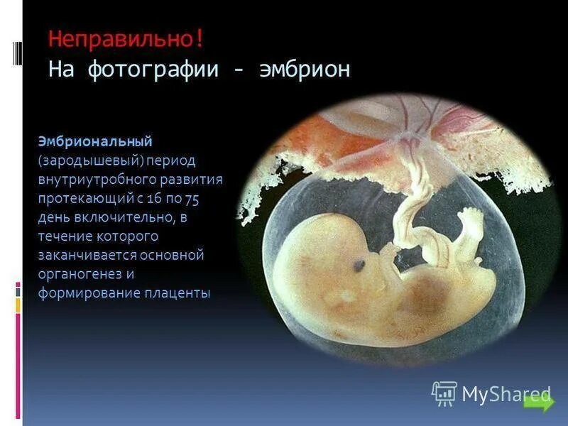 Плацента на какой неделе. Период формирования плаценты. Формирование плаценты зародыша. Формирование органов эмбриона. Эмбриональный период сроки.