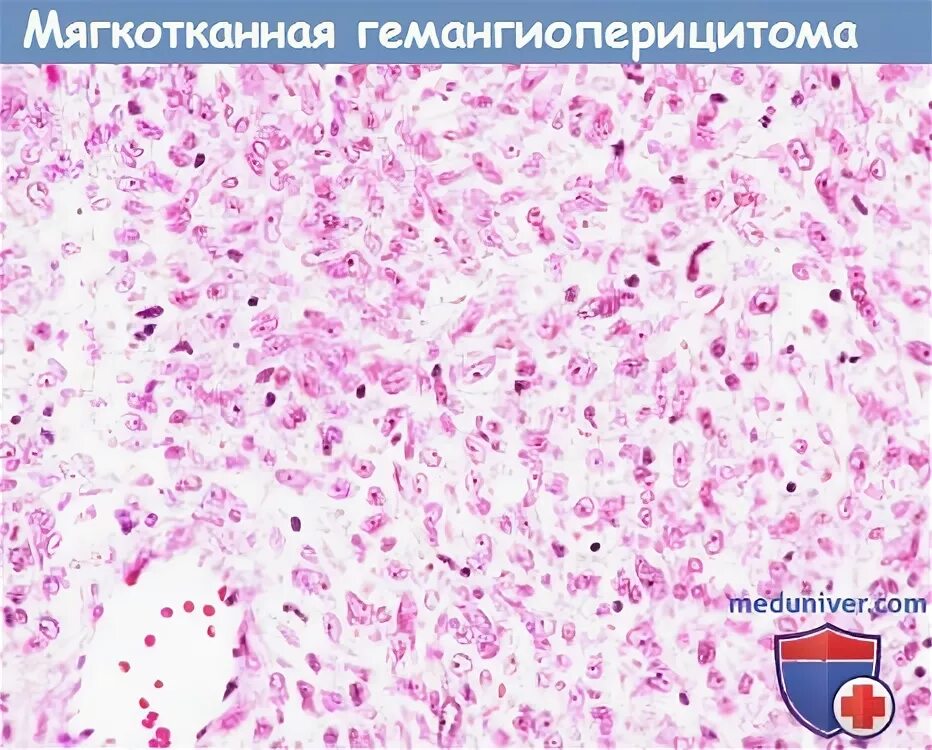 Гистология и биопсия. Гистология и биопсия